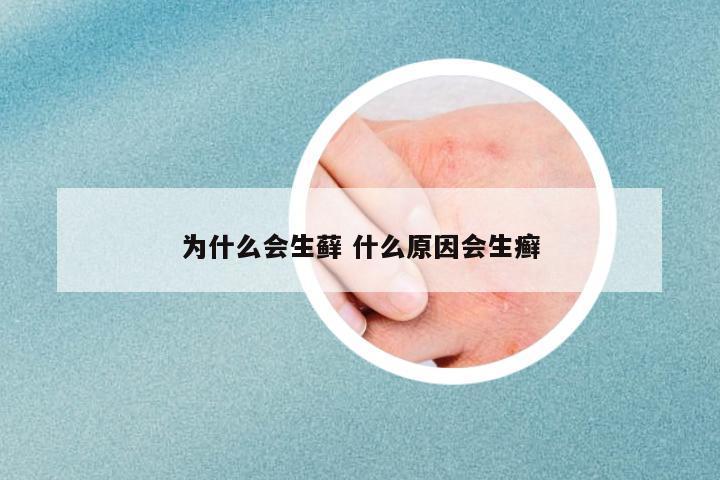 為什么會生蘚 什么原因會生癬