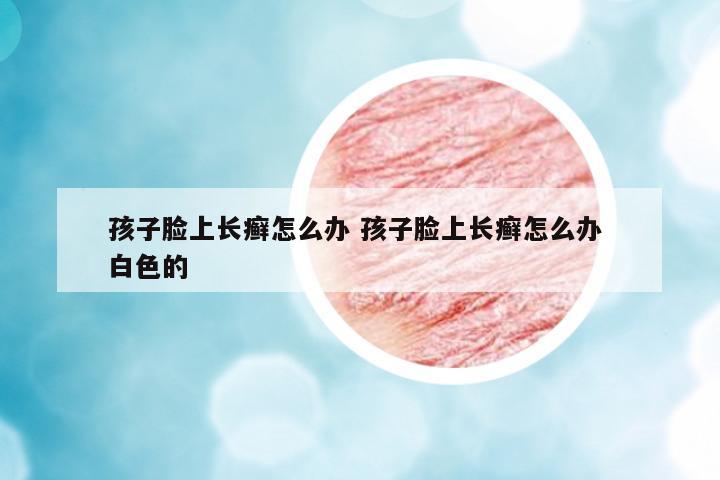 孩子臉上長(zhǎng)癬怎么辦 孩子臉上長(zhǎng)癬怎么辦 白色的