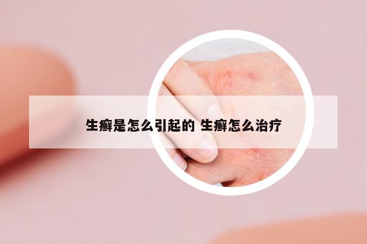 生癬是怎么引起的 生癬怎么治療
