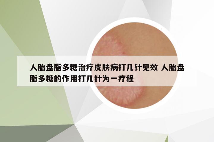 人胎盤(pán)脂多糖治療皮膚病打幾針見(jiàn)效 人胎盤(pán)脂多糖的作用打幾針為一療程