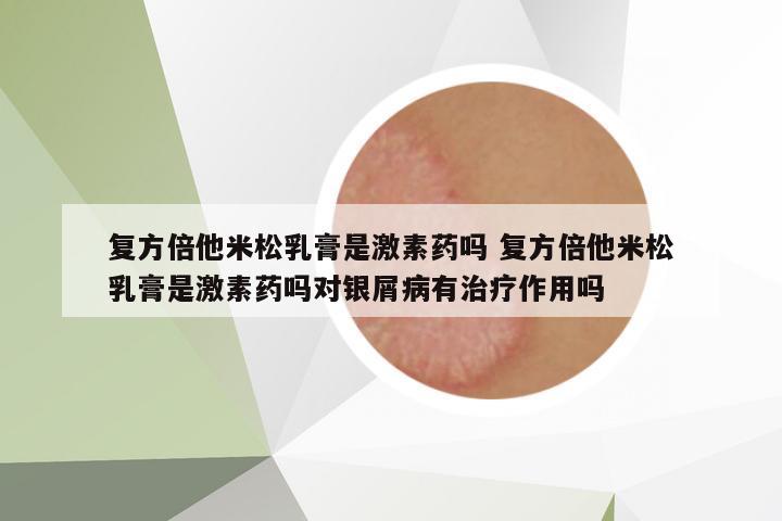復(fù)方倍他米松乳膏是激素藥嗎 復(fù)方倍他米松乳膏是激素藥嗎對(duì)銀屑病有治療作用嗎