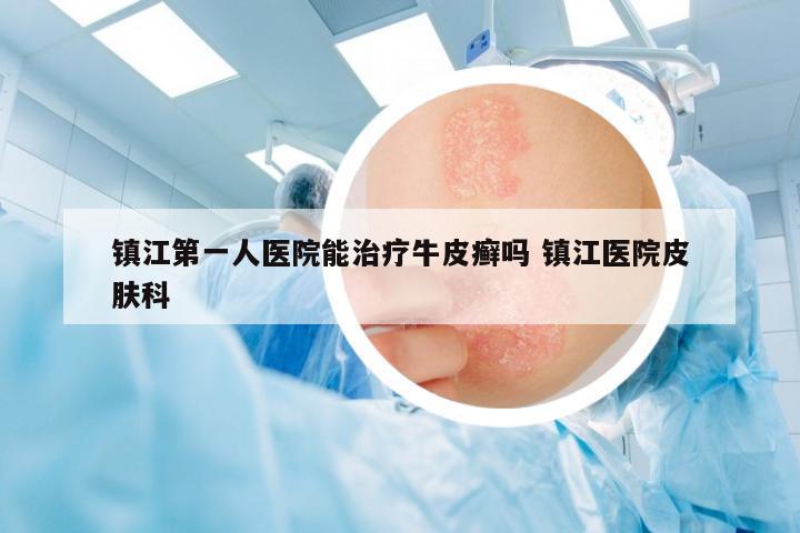 鎮(zhèn)江第一人醫(yī)院能治療牛皮癬嗎 鎮(zhèn)江醫(yī)院皮膚科