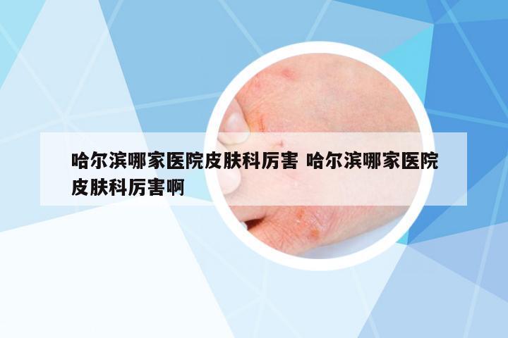 哈爾濱哪家醫(yī)院皮膚科厲害 哈爾濱哪家醫(yī)院皮膚科厲害啊