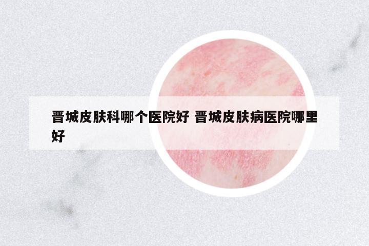 晉城皮膚科哪個醫(yī)院好 晉城皮膚病醫(yī)院哪里好