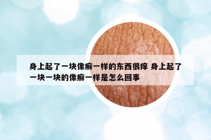 身上起了一塊像癬一樣的東西很癢 身上起了一塊一塊的像癬一樣是怎么回事