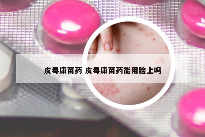 皮毒康苗藥 皮毒康苗藥能用臉上嗎