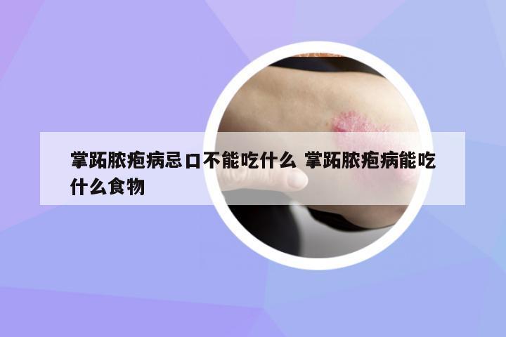 掌跖膿皰病忌口不能吃什么 掌跖膿皰病能吃什么食物