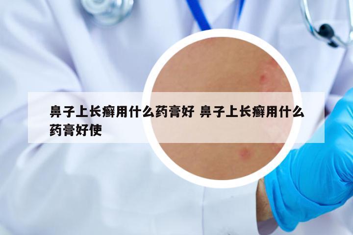 鼻子上長(zhǎng)癬用什么藥膏好 鼻子上長(zhǎng)癬用什么藥膏好使