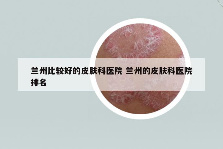 蘭州比較好的皮膚科醫(yī)院 蘭州的皮膚科醫(yī)院排名