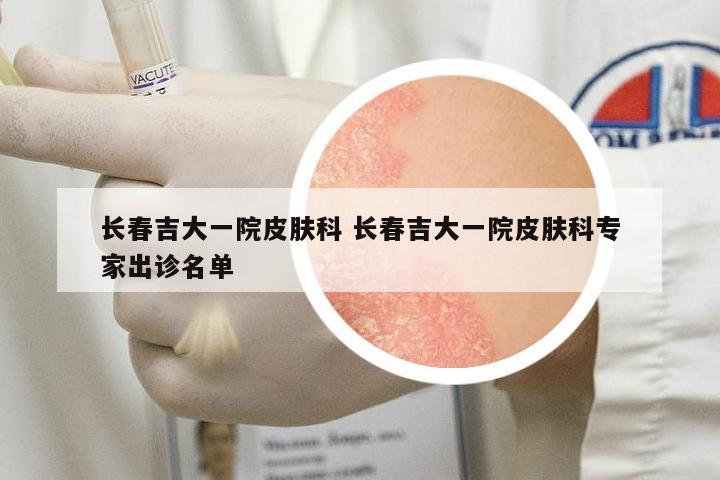 長春吉大一院皮膚科 長春吉大一院皮膚科專家出診名單