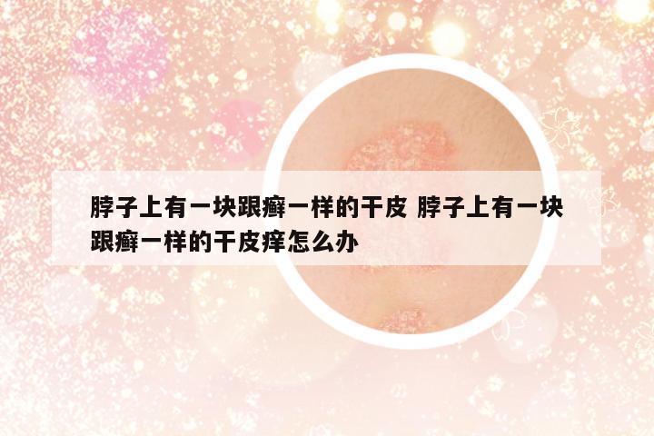 脖子上有一塊跟癬一樣的干皮 脖子上有一塊跟癬一樣的干皮癢怎么辦