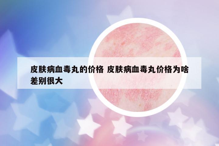 皮膚病血毒丸的價格 皮膚病血毒丸價格為啥差別很大