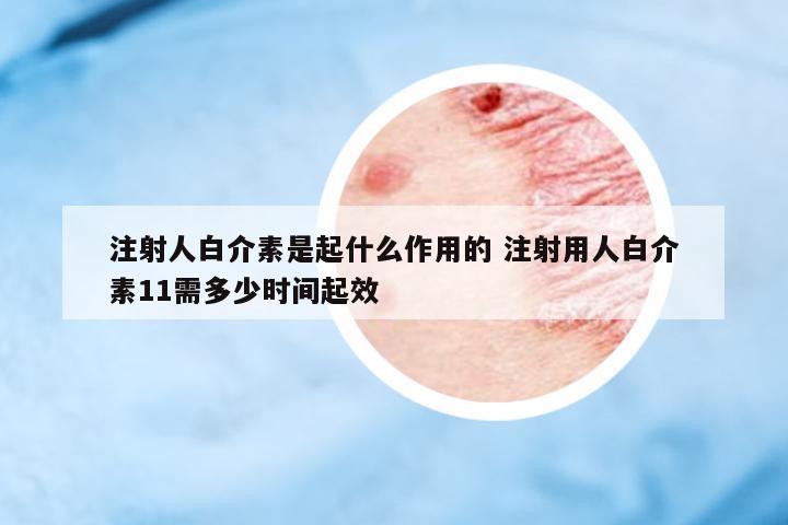 注射人白介素是起什么作用的 注射用人白介素11需多少時(shí)間起效
