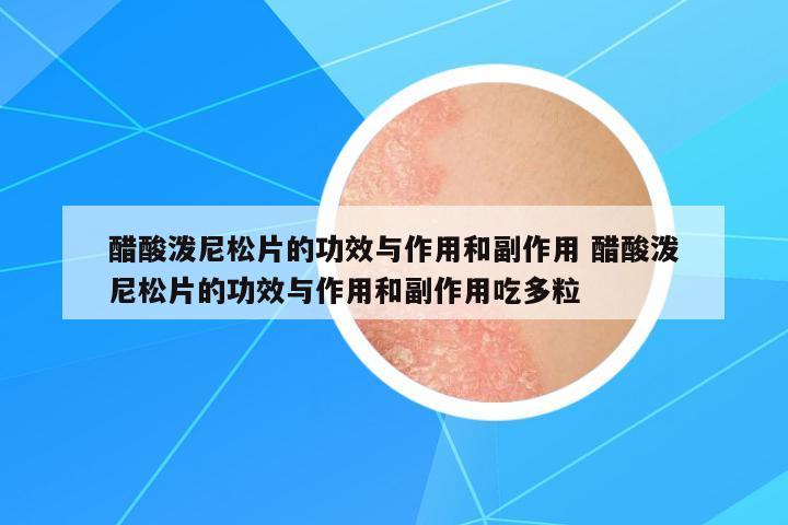 醋酸潑尼松片的功效與作用和副作用 醋酸潑尼松片的功效與作用和副作用吃多粒