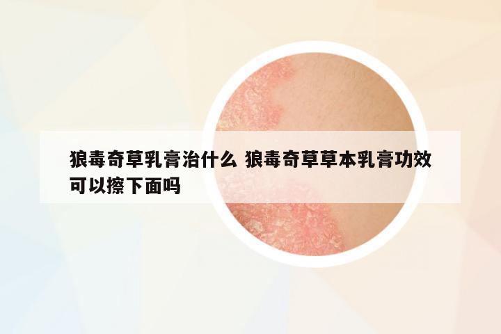 狼毒奇草乳膏治什么 狼毒奇草草本乳膏功效可以擦下面嗎