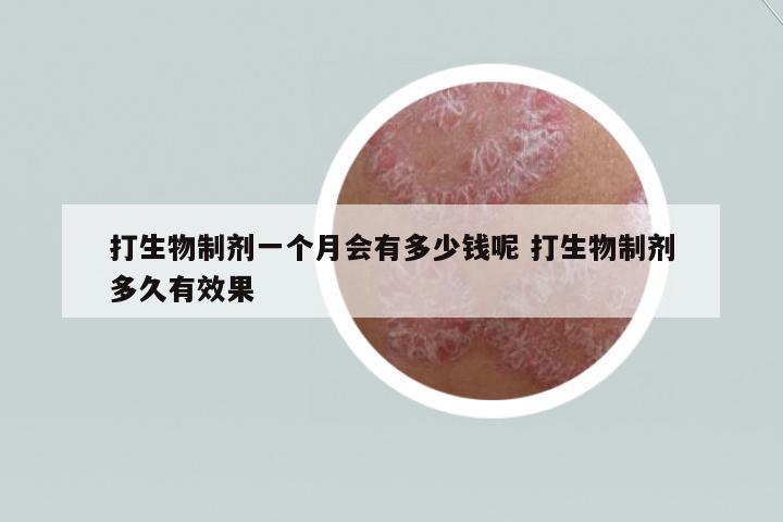 打生物制劑一個(gè)月會(huì)有多少錢呢 打生物制劑多久有效果