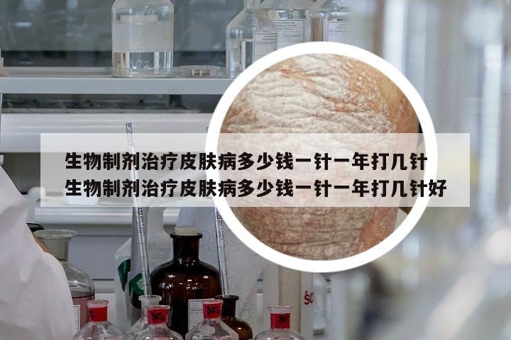 生物制劑治療皮膚病多少錢一針一年打幾針 生物制劑治療皮膚病多少錢一針一年打幾針好