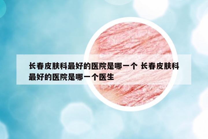 長(zhǎng)春皮膚科最好的醫(yī)院是哪一個(gè) 長(zhǎng)春皮膚科最好的醫(yī)院是哪一個(gè)醫(yī)生