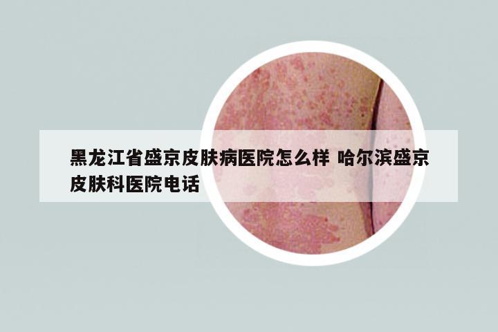 黑龍江省盛京皮膚病醫(yī)院怎么樣 哈爾濱盛京皮膚科醫(yī)院電話(huà)