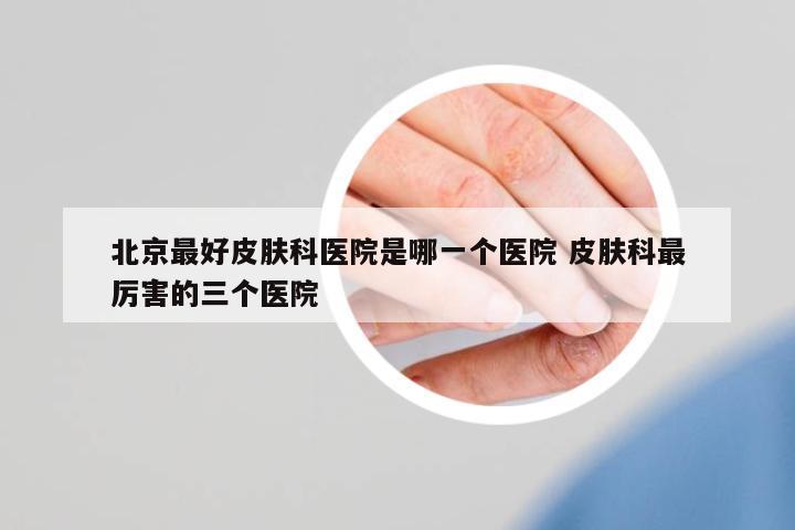 北京最好皮膚科醫(yī)院是哪一個(gè)醫(yī)院 皮膚科最厲害的三個(gè)醫(yī)院