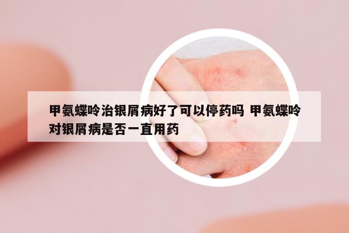 甲氨蝶呤治銀屑病好了可以停藥嗎 甲氨蝶呤對銀屑病是否一直用藥