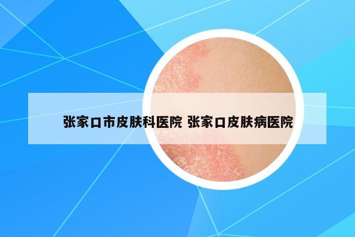 張家口市皮膚科醫(yī)院 張家口皮膚病醫(yī)院