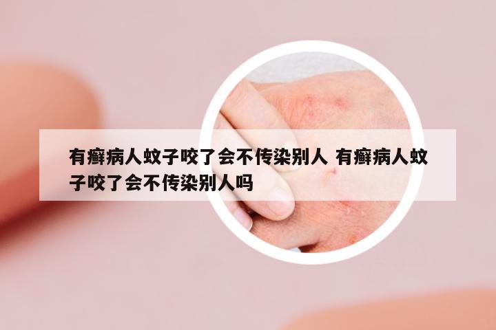 有癬病人蚊子咬了會不傳染別人 有癬病人蚊子咬了會不傳染別人嗎
