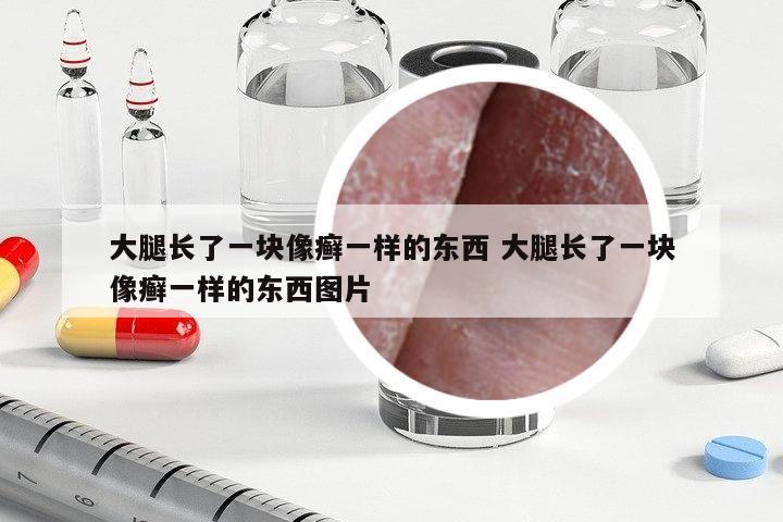 大腿長了一塊像癬一樣的東西 大腿長了一塊像癬一樣的東西圖片