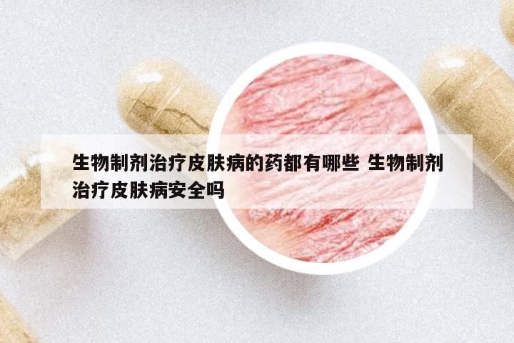 生物制劑治療皮膚病的藥都有哪些 生物制劑治療皮膚病安全嗎