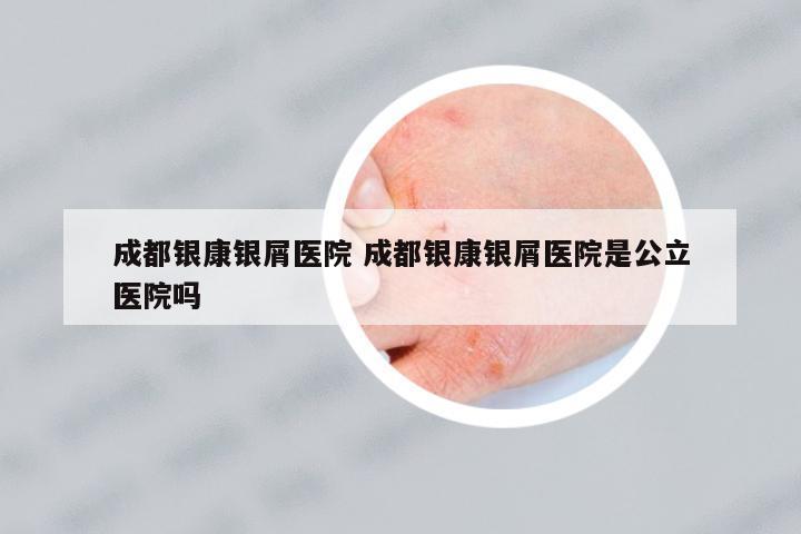 成都銀康銀屑醫(yī)院 成都銀康銀屑醫(yī)院是公立醫(yī)院嗎