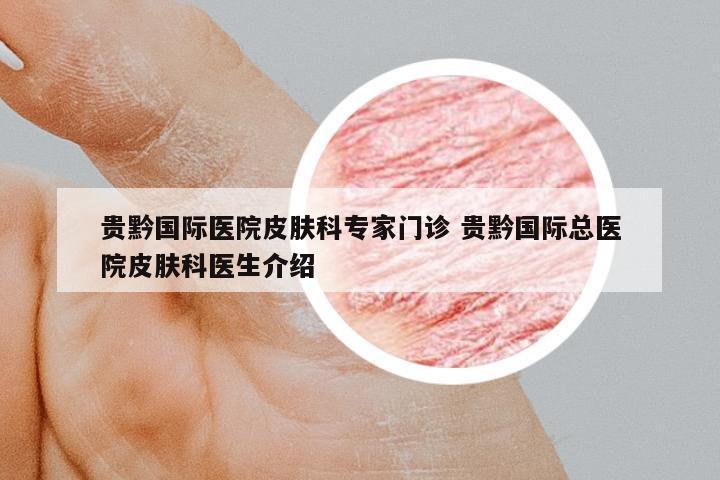 貴黔國(guó)際醫(yī)院皮膚科專家門診 貴黔國(guó)際總醫(yī)院皮膚科醫(yī)生介紹