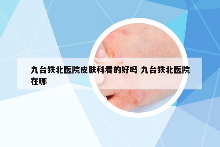 九臺鐵北醫(yī)院皮膚科看的好嗎 九臺鐵北醫(yī)院在哪