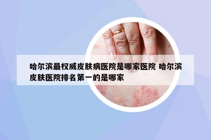 哈爾濱最權(quán)威皮膚病醫(yī)院是哪家醫(yī)院 哈爾濱皮膚醫(yī)院排名第一的是哪家