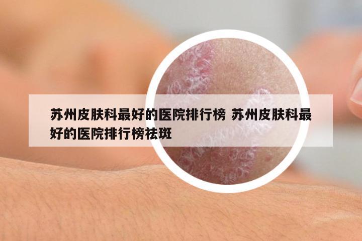 蘇州皮膚科最好的醫(yī)院排行榜 蘇州皮膚科最好的醫(yī)院排行榜祛斑