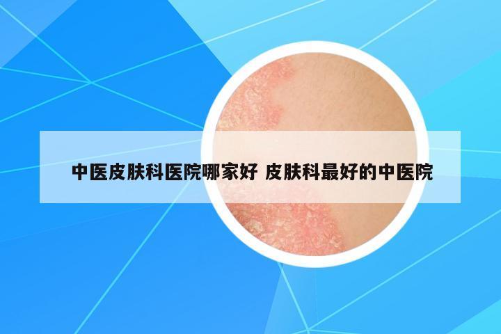 中醫(yī)皮膚科醫(yī)院哪家好 皮膚科最好的中醫(yī)院