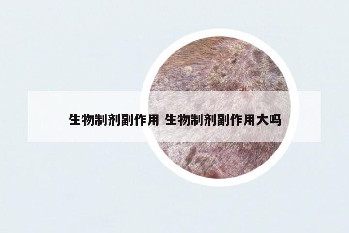 生物制劑副作用 生物制劑副作用大嗎