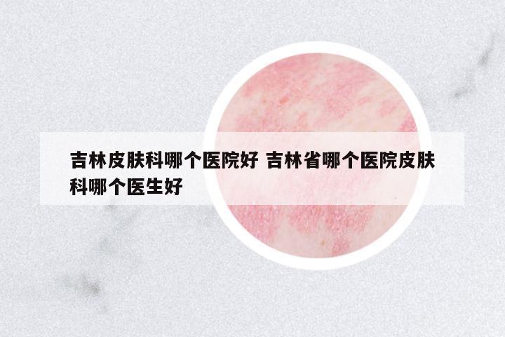 吉林皮膚科哪個(gè)醫(yī)院好 吉林省哪個(gè)醫(yī)院皮膚科哪個(gè)醫(yī)生好