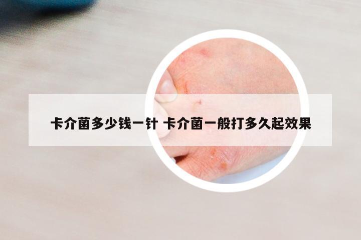 卡介菌多少錢一針 卡介菌一般打多久起效果