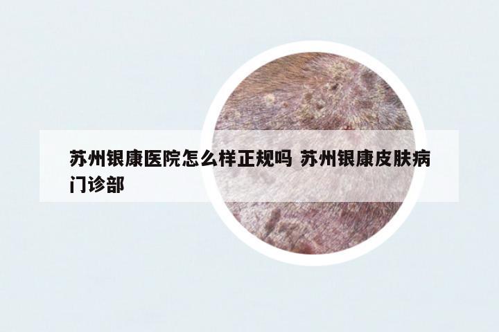 蘇州銀康醫(yī)院怎么樣正規(guī)嗎 蘇州銀康皮膚病門診部