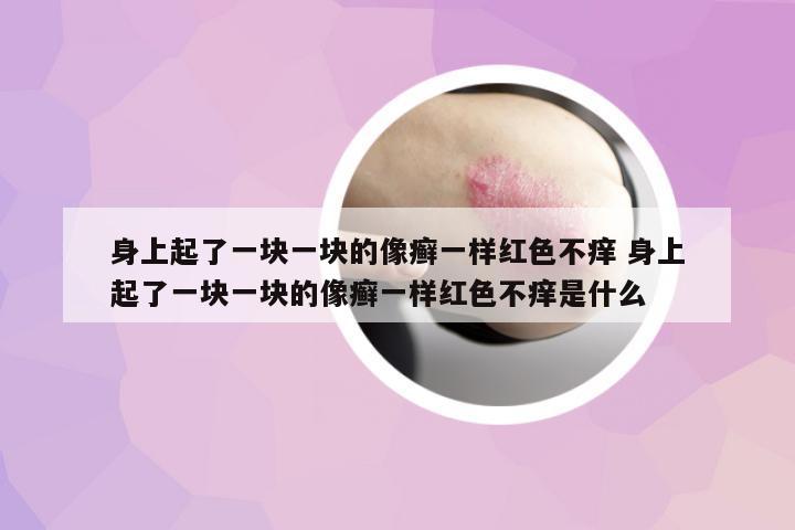 身上起了一塊一塊的像癬一樣紅色不癢 身上起了一塊一塊的像癬一樣紅色不癢是什么