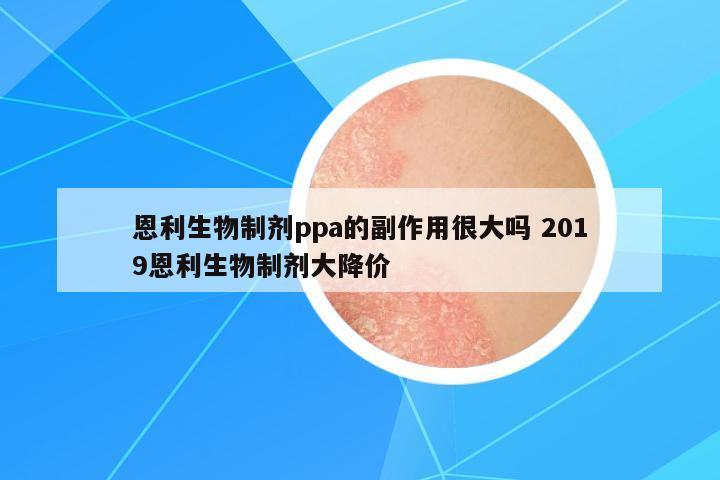 恩利生物制劑ppa的副作用很大嗎 2019恩利生物制劑大降價(jià)