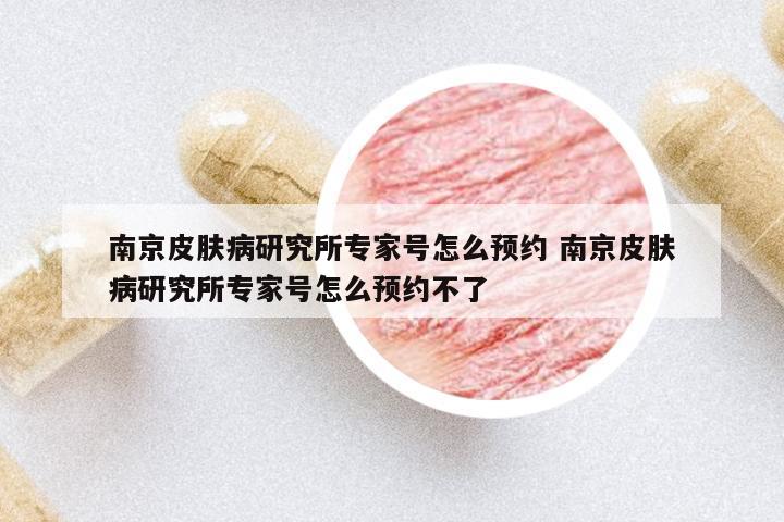 南京皮膚病研究所專家號(hào)怎么預(yù)約 南京皮膚病研究所專家號(hào)怎么預(yù)約不了