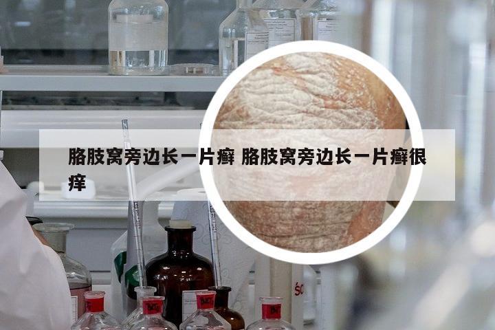 胳肢窩旁邊長一片癬 胳肢窩旁邊長一片癬很癢