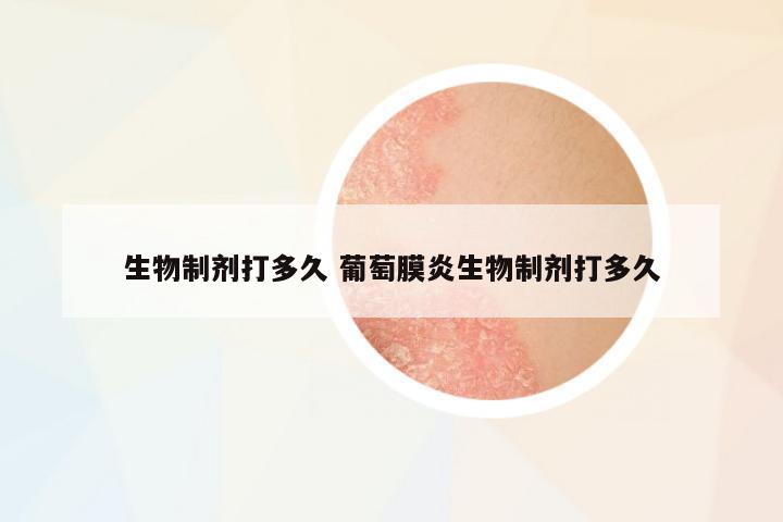 生物制劑打多久 葡萄膜炎生物制劑打多久