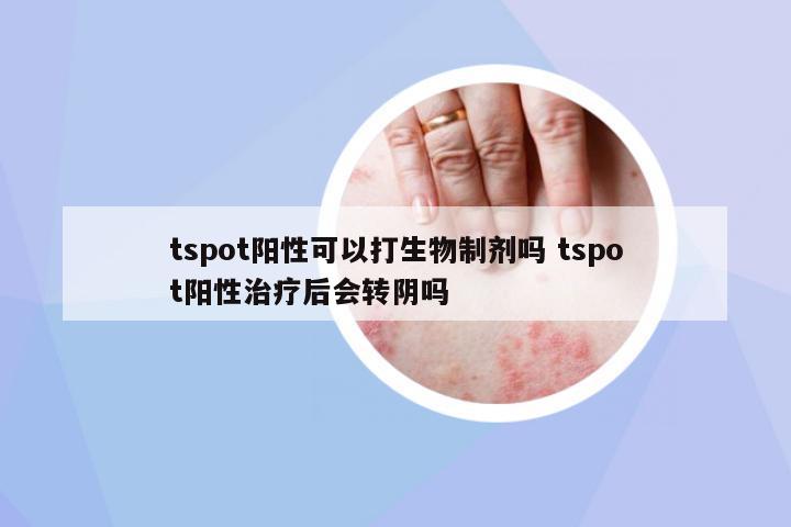 tspot陽(yáng)性可以打生物制劑嗎 tspot陽(yáng)性治療后會(huì)轉(zhuǎn)陰嗎