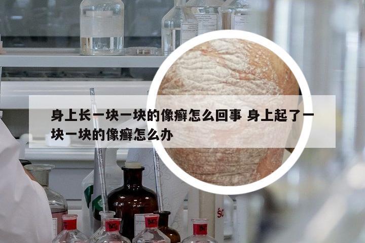 身上長(zhǎng)一塊一塊的像癬怎么回事 身上起了一塊一塊的像癬怎么辦