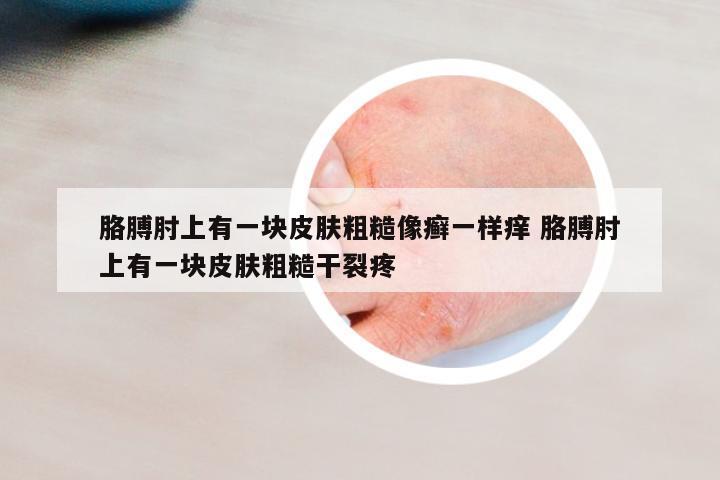 胳膊肘上有一塊皮膚粗糙像癬一樣癢 胳膊肘上有一塊皮膚粗糙干裂疼