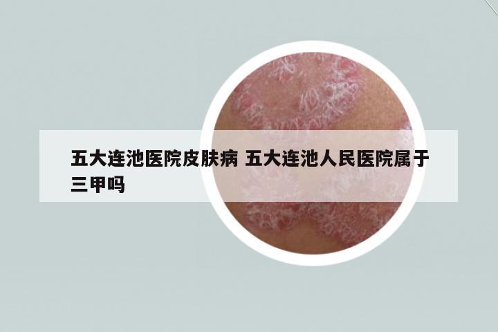 五大連池醫(yī)院皮膚病 五大連池人民醫(yī)院屬于三甲嗎
