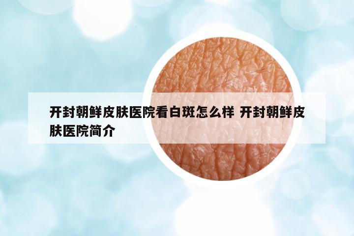 開(kāi)封朝鮮皮膚醫(yī)院看白斑怎么樣 開(kāi)封朝鮮皮膚醫(yī)院簡(jiǎn)介