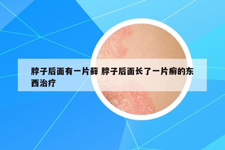 脖子后面有一片蘚 脖子后面長了一片癬的東西治療